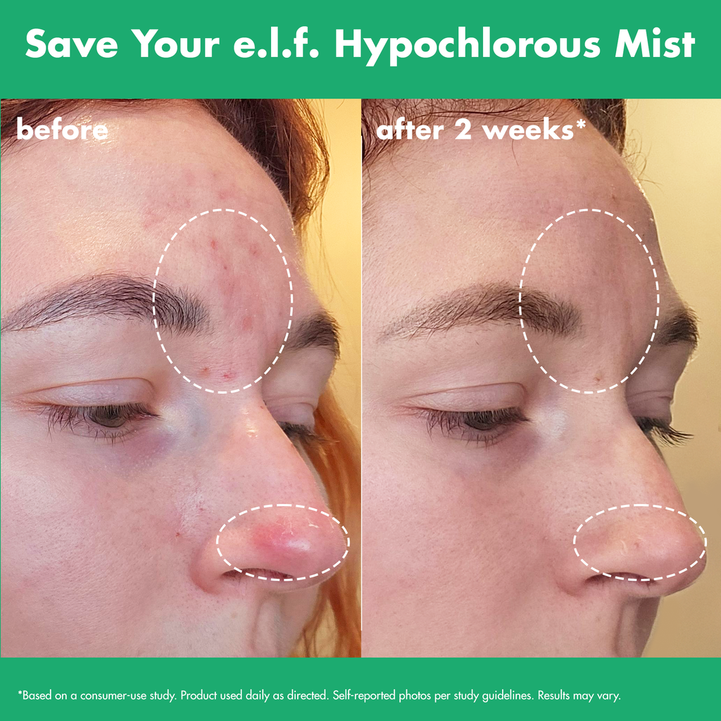 Save Your e.l.f. Hypochlorous Mist